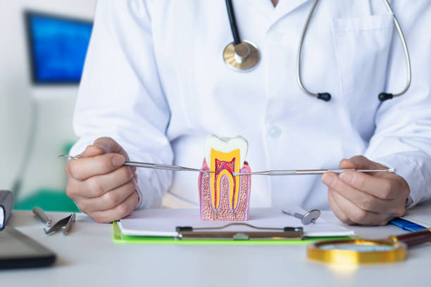 Best Knocked-Out Tooth (Avulsed Tooth) Treatment in West Terre Haute, IN